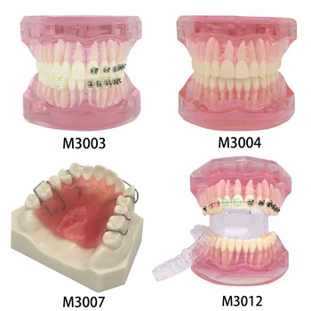 Стоматологичен Ортодонтическая модел на зъбите с металлокерамическими брекетами и шнорхел за лингвальных скоби